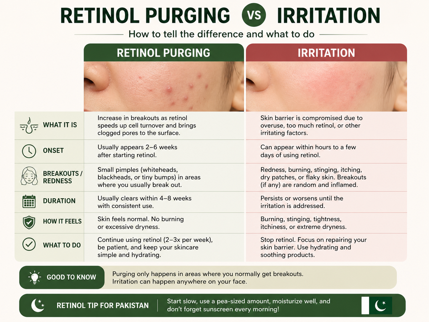 Retinol purging vs irritation signs for beginners in Pakistan