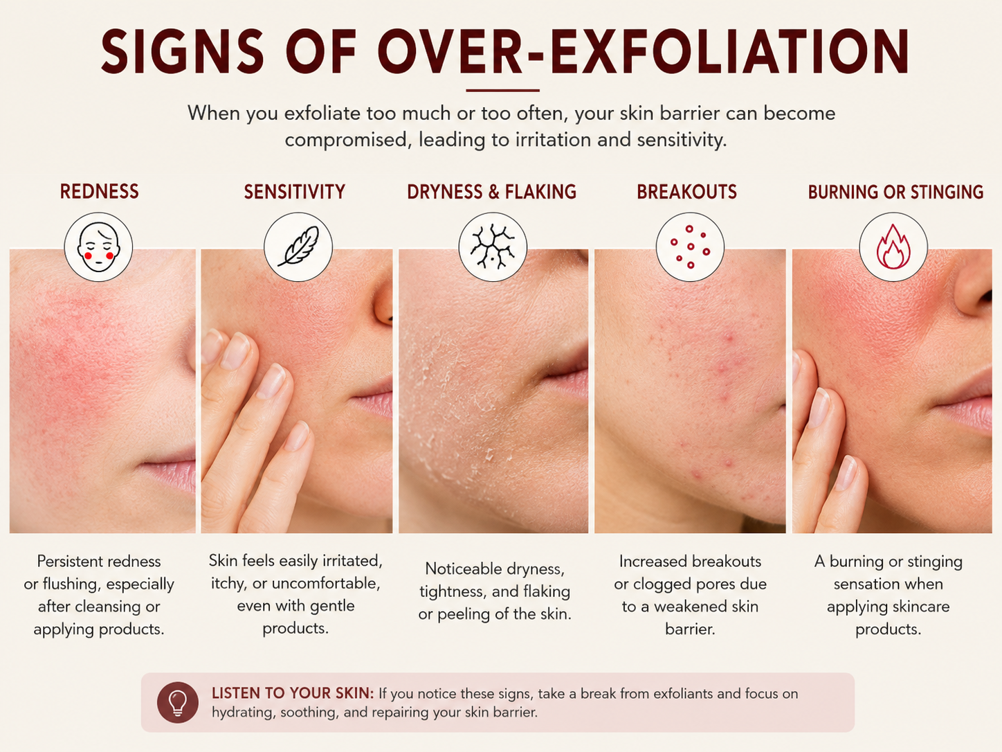 signs of over-exfoliation and ceramides skin barrier repair