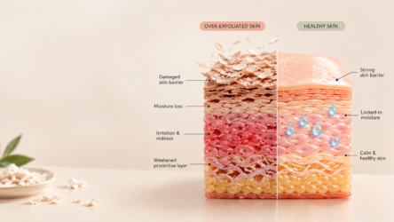Over-exfoliation damages your skin barrier and causes irritation